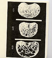 骨粗しょう症（骨の構造）漢方薬・生薬の通信販売